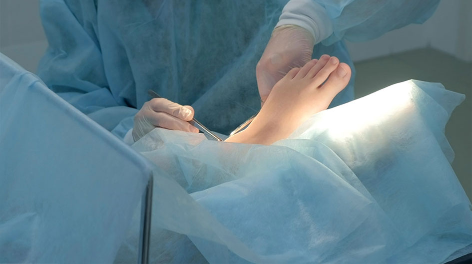 foot-and-ankle-surgery