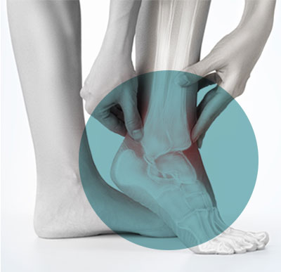 foot-and-ankle-surgery