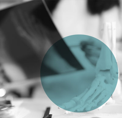 orthopaedic-trauma-surgery